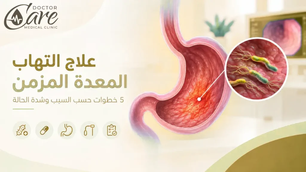 علاج التهاب المعدة المزمن